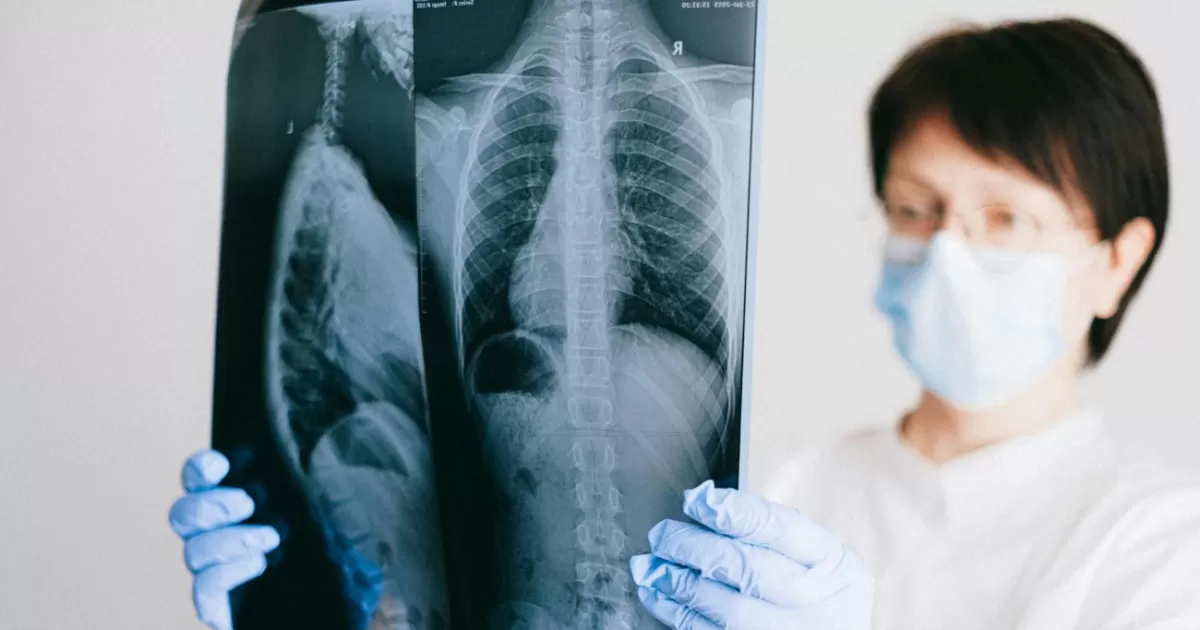 Proteja los pulmones en Bogotá con estos 5 ejercicios clave