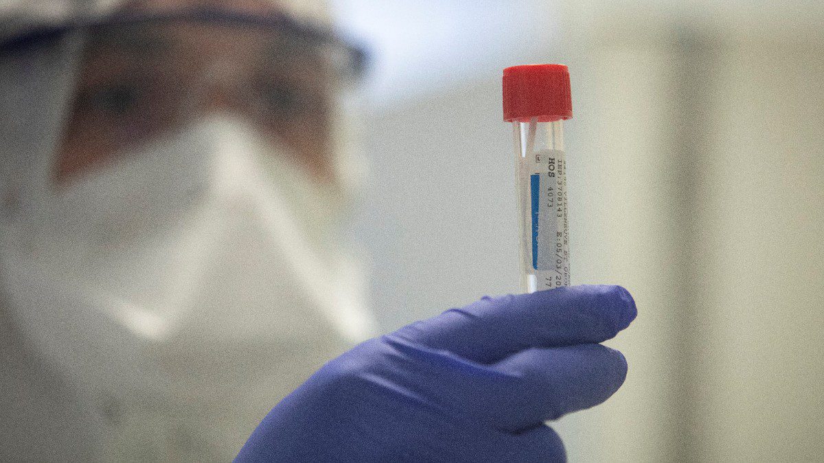 Quién no excluye que el virus Cower provenga de fugas en el laboratorio