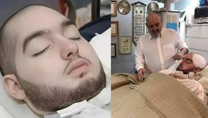 El "Príncipe inactivo" de Arabia Saudita murió después de más de 20 años en coma